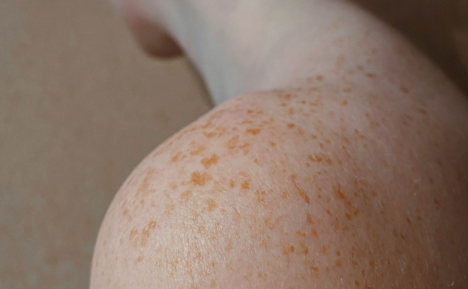 Swiss MediShop Injecteurs Demander une demo