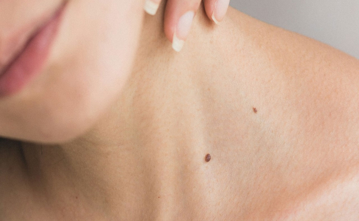 Swiss MediShop Plasma gun Demander une demo